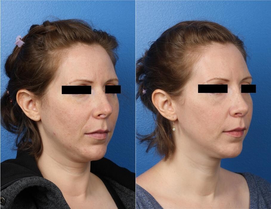 Images Gotham Plastic Surgery