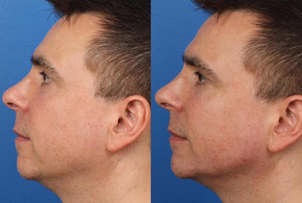 Images Gotham Plastic Surgery