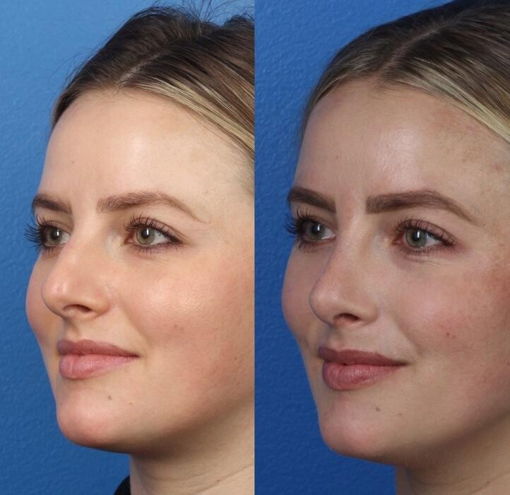 Images Gotham Plastic Surgery