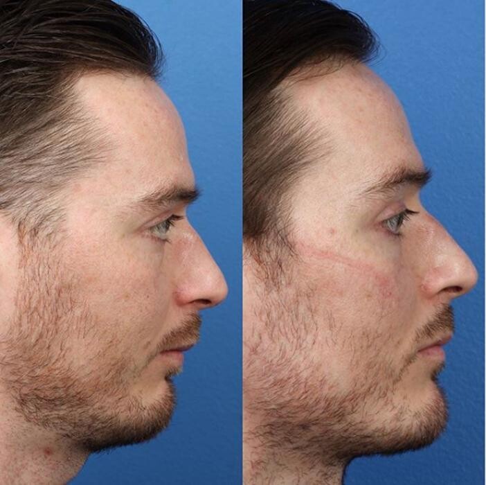 Images Gotham Plastic Surgery