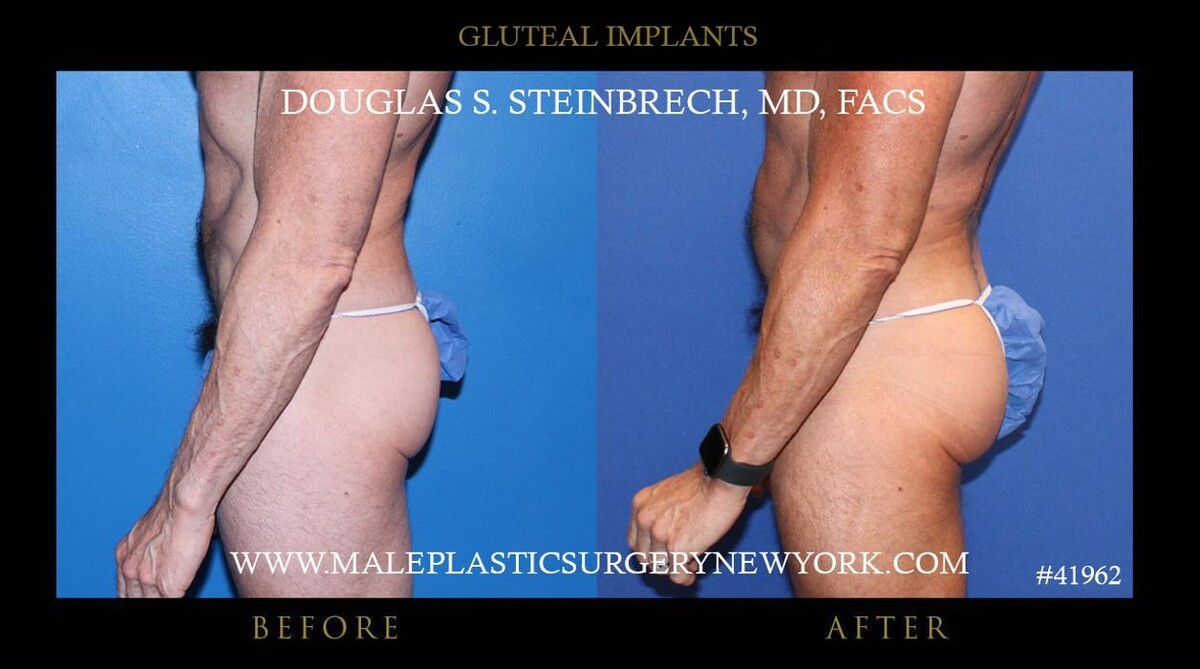 Images Gotham Plastic Surgery
