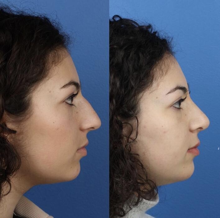 Images Gotham Plastic Surgery