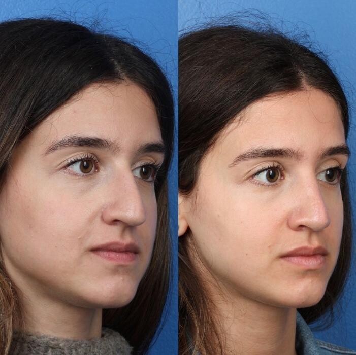 Images Gotham Plastic Surgery