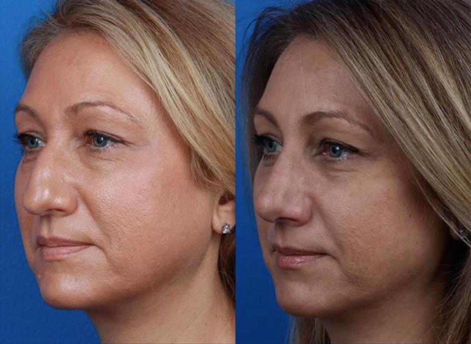 Images Gotham Plastic Surgery