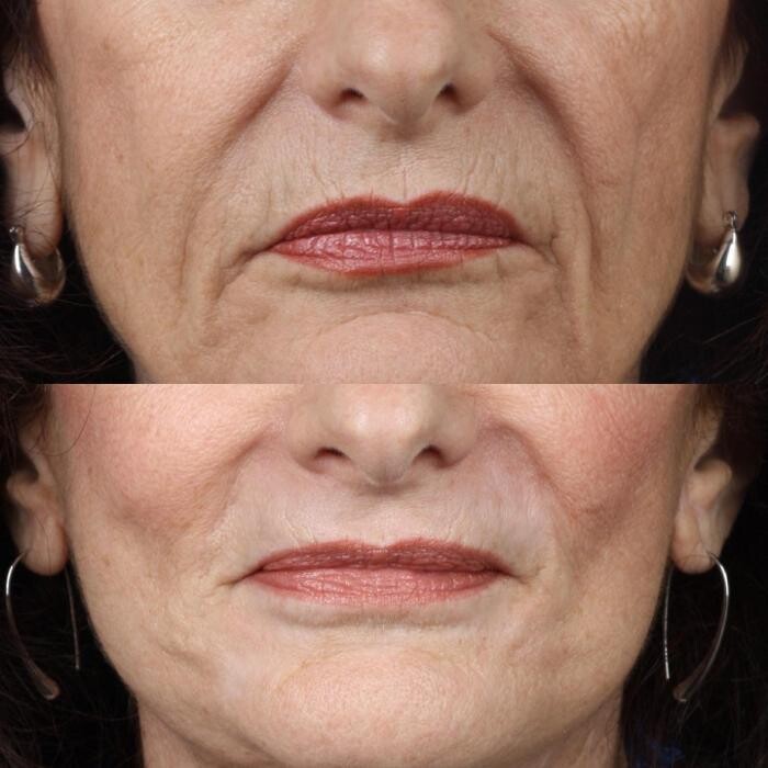 Images Gotham Plastic Surgery