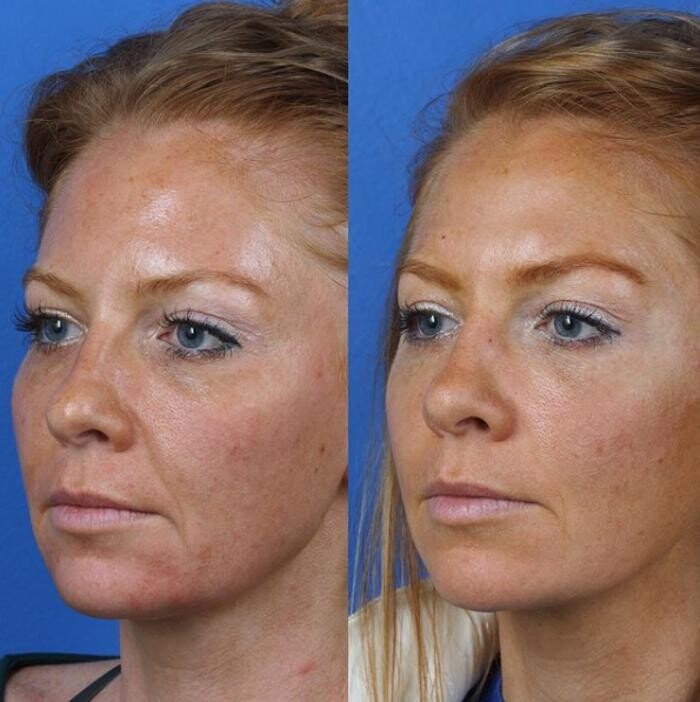 Images Gotham Plastic Surgery