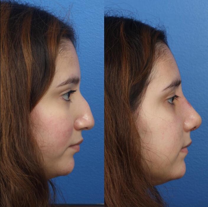 Images Gotham Plastic Surgery