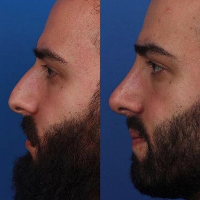 Images Gotham Plastic Surgery