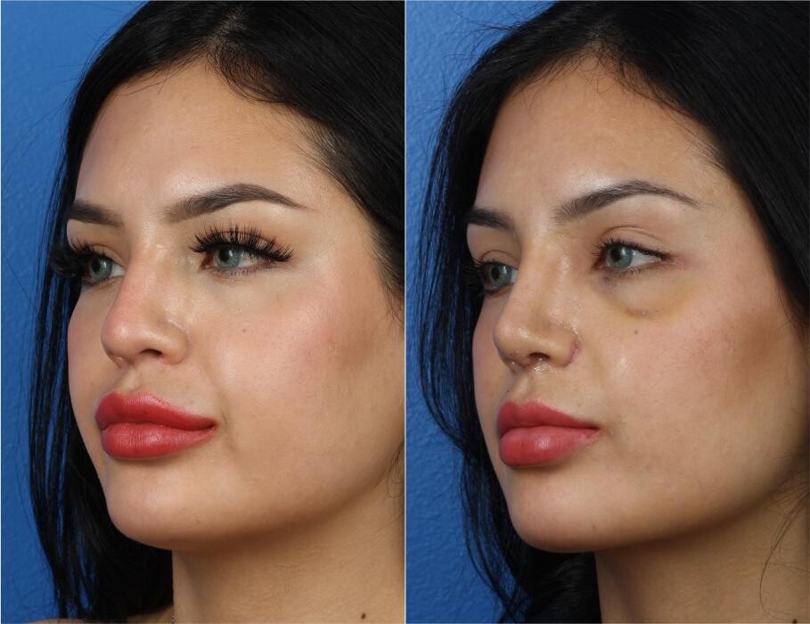 Images Gotham Plastic Surgery