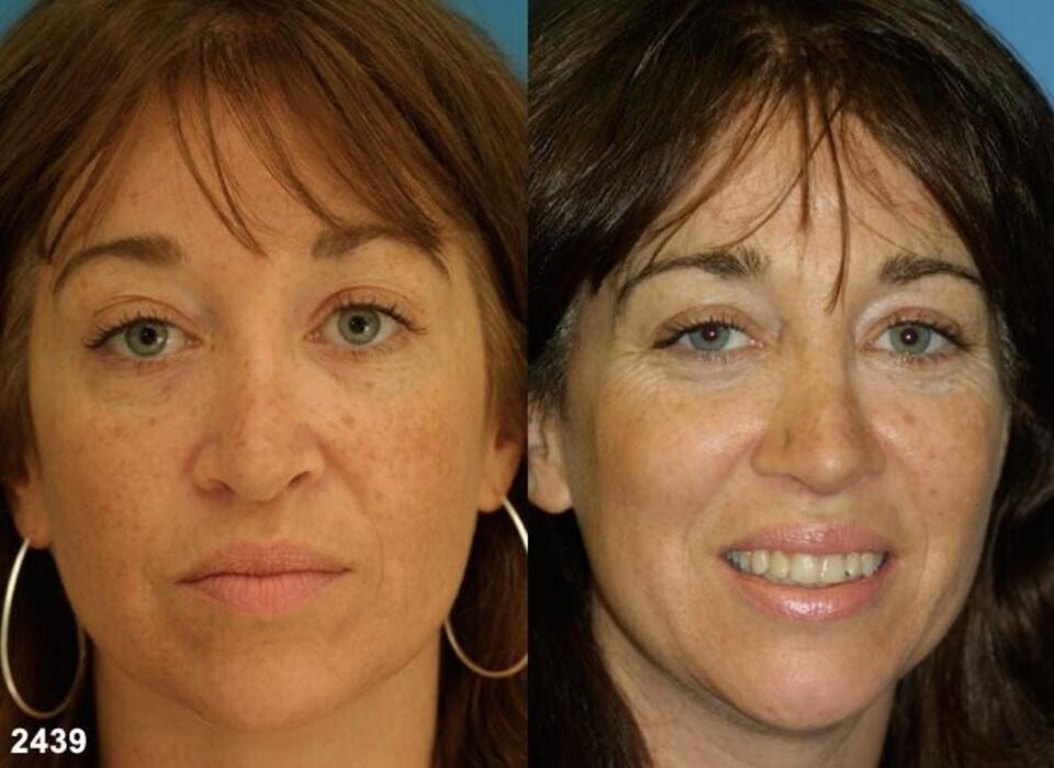 Images Gotham Plastic Surgery