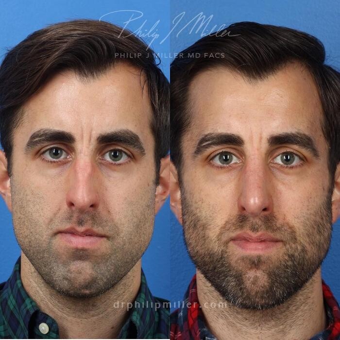 Images Gotham Plastic Surgery