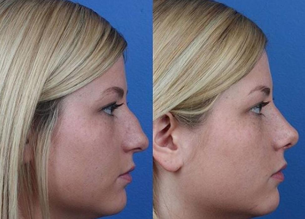 Images Gotham Plastic Surgery