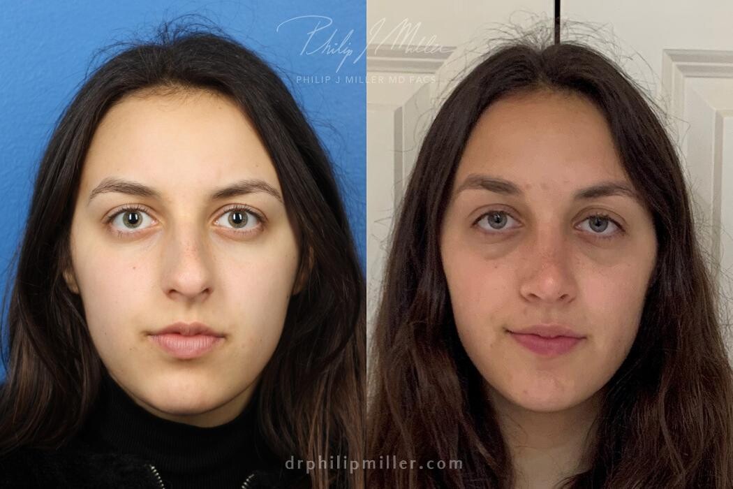 Images Gotham Plastic Surgery