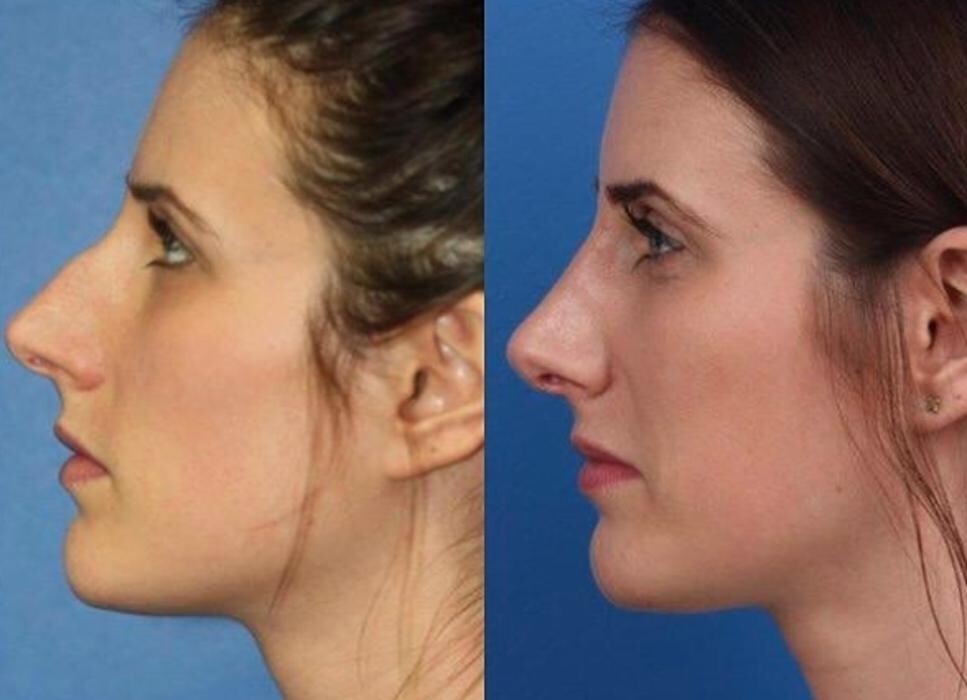 Images Gotham Plastic Surgery