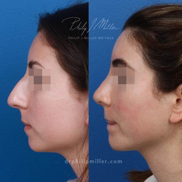 Images Gotham Plastic Surgery