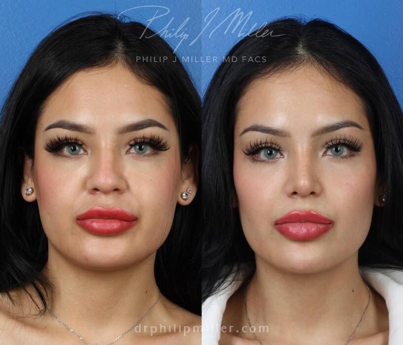 Images Gotham Plastic Surgery