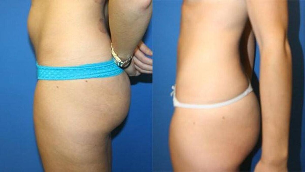 Images Gotham Plastic Surgery