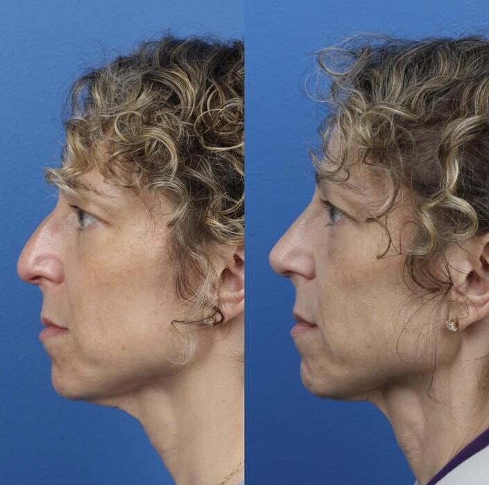 Images Gotham Plastic Surgery