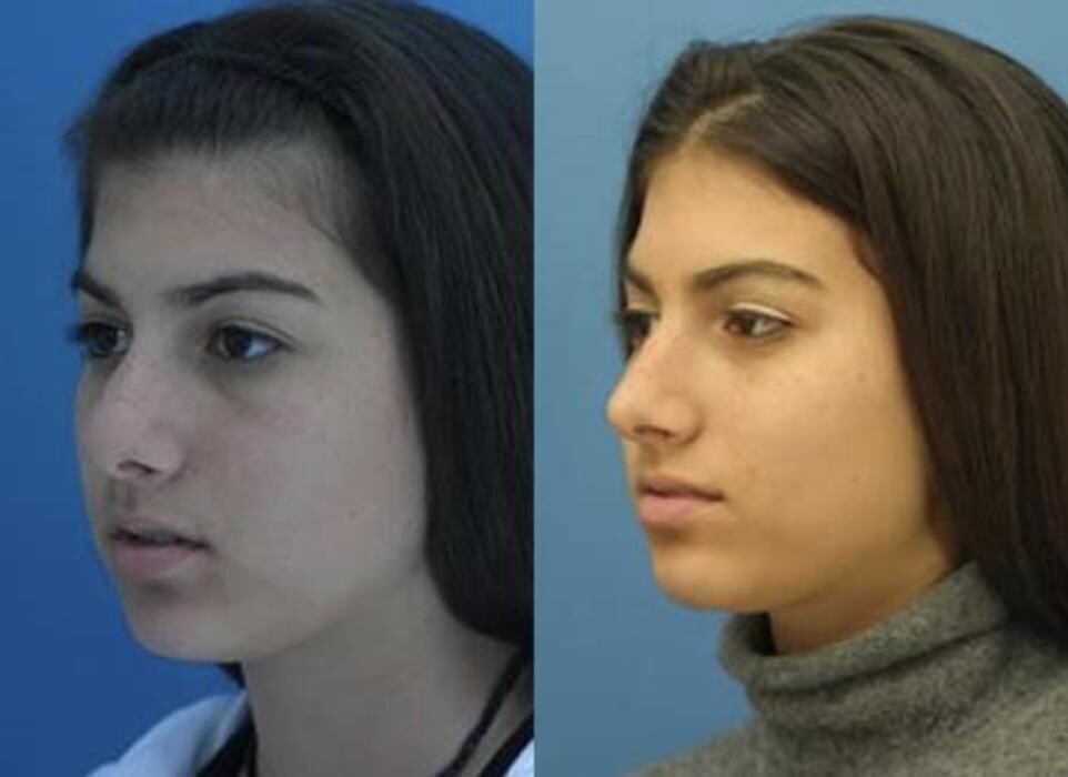 Images Gotham Plastic Surgery