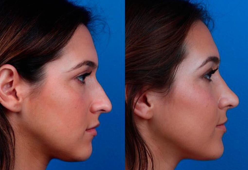 Images Gotham Plastic Surgery