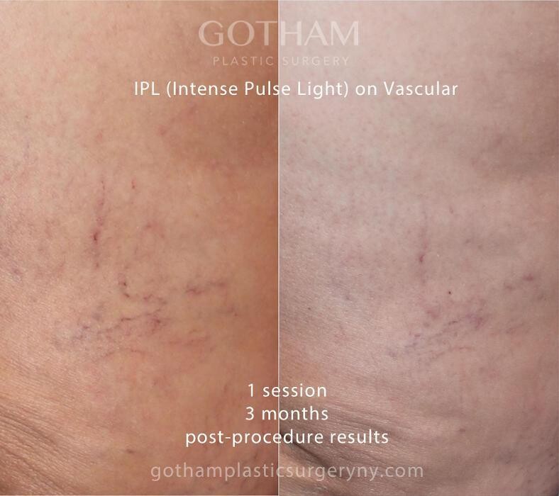 Images Gotham Plastic Surgery