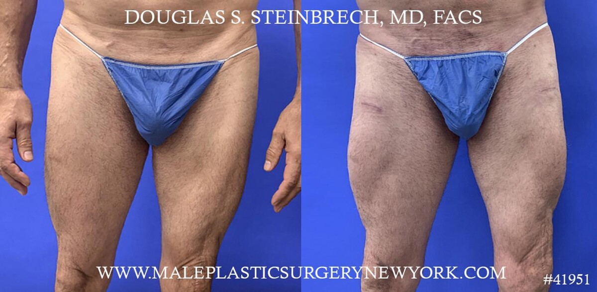 Images Gotham Plastic Surgery