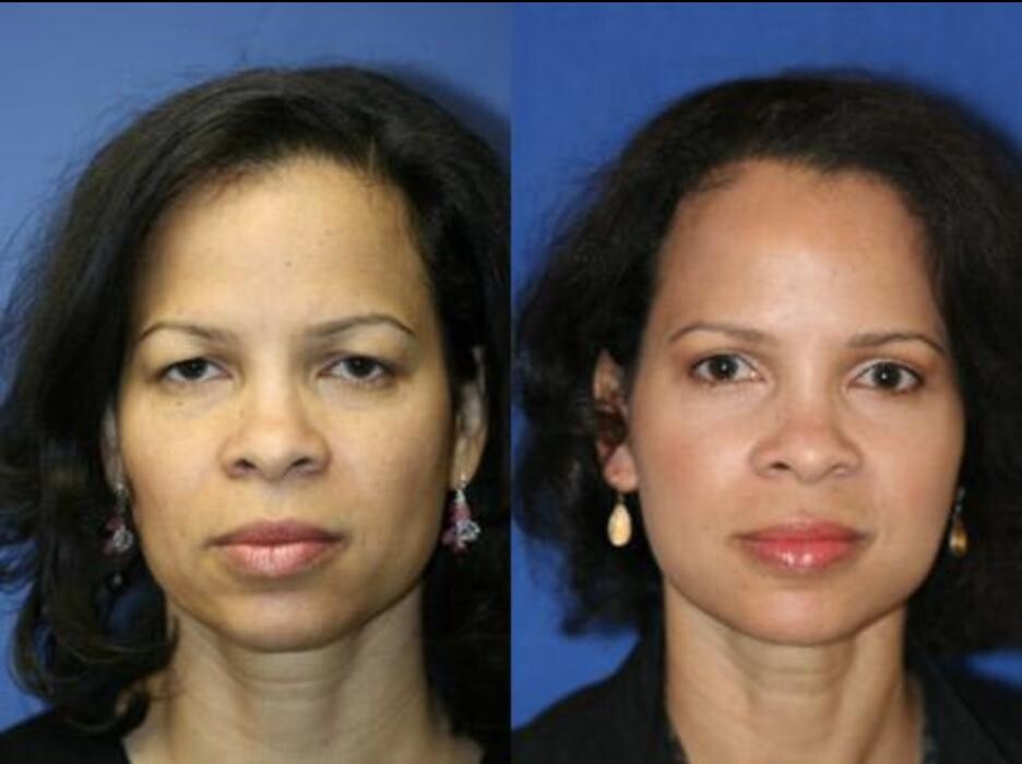 Images Gotham Plastic Surgery