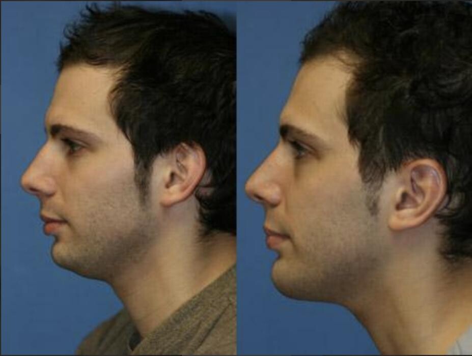 Images Gotham Plastic Surgery