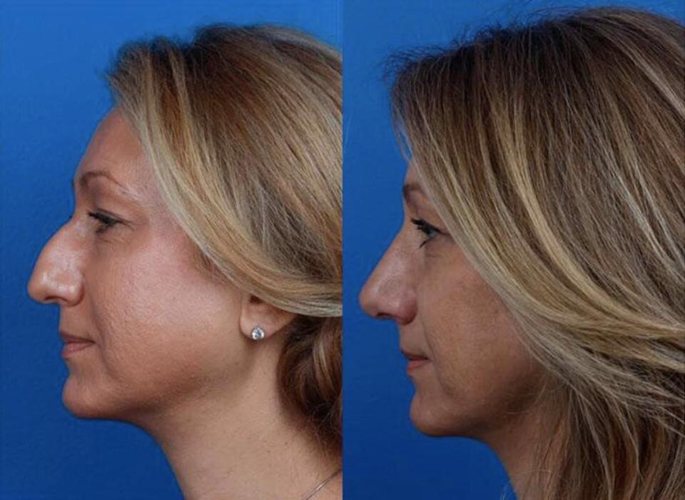 Images Gotham Plastic Surgery