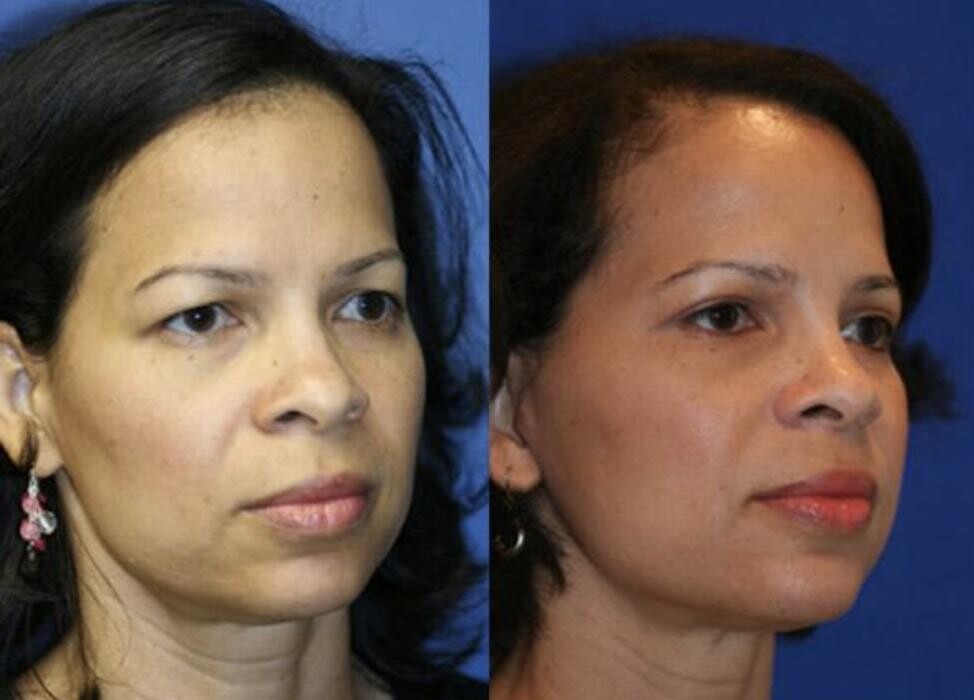 Images Gotham Plastic Surgery