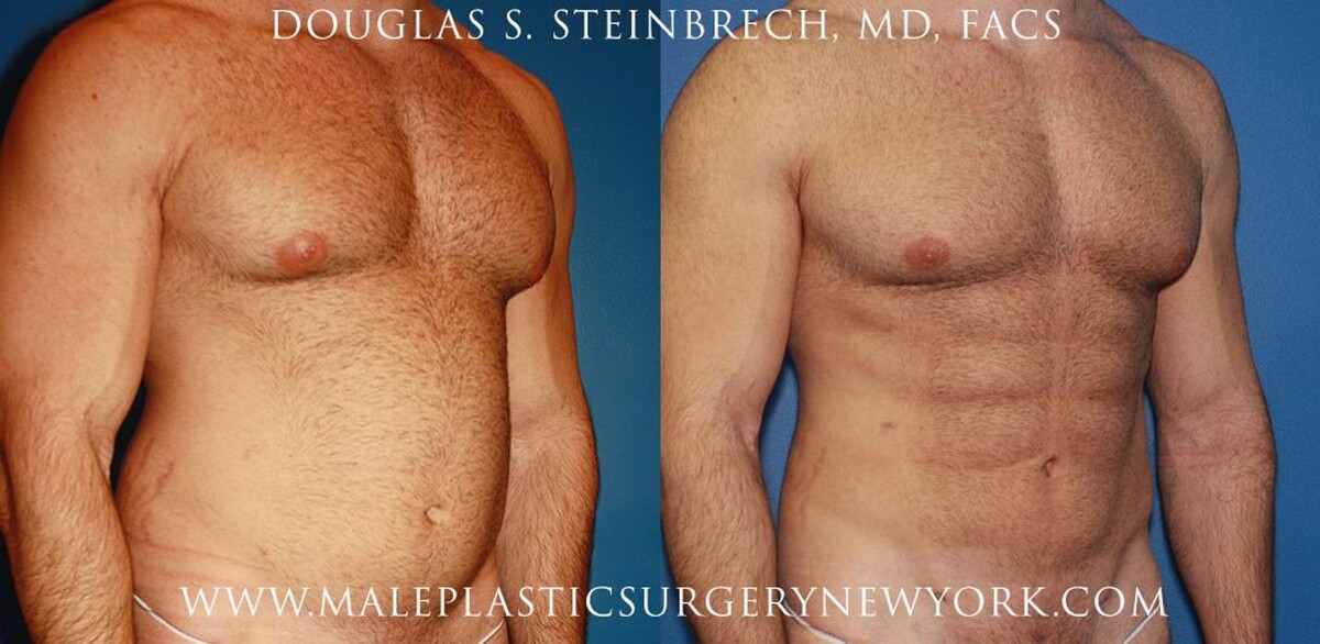 Images Gotham Plastic Surgery