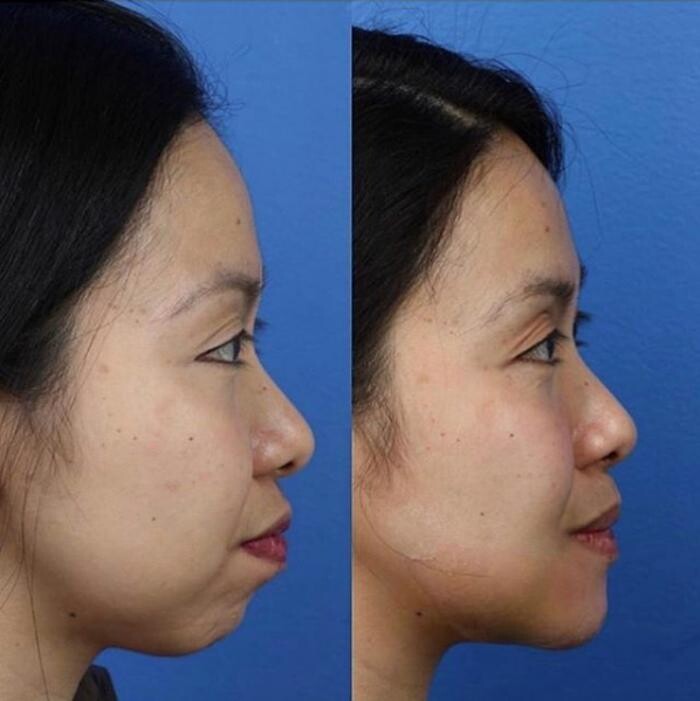 Images Gotham Plastic Surgery