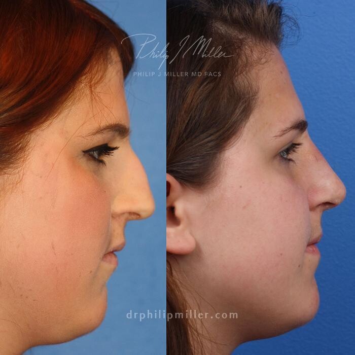 Images Gotham Plastic Surgery