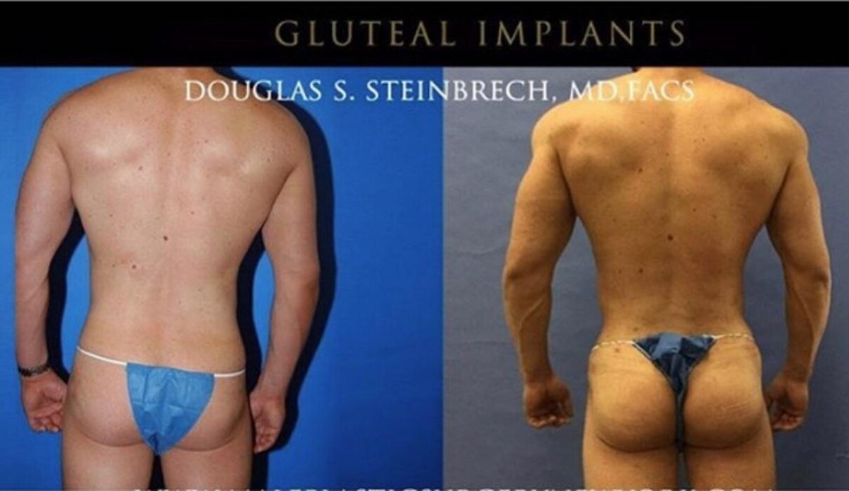 Images Gotham Plastic Surgery