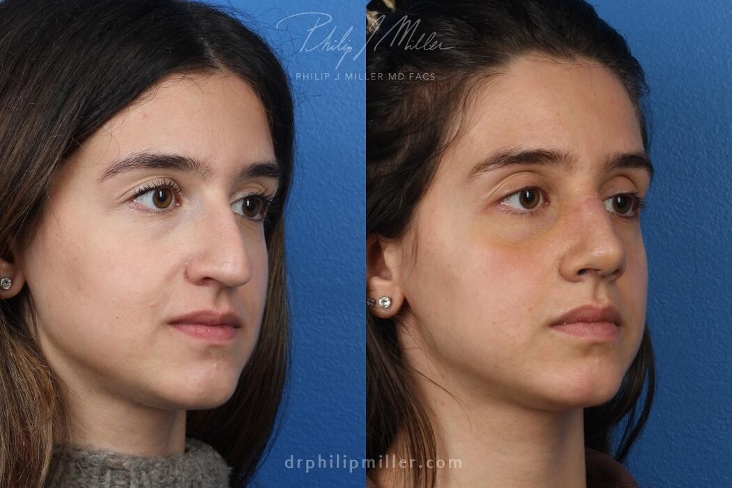Images Gotham Plastic Surgery