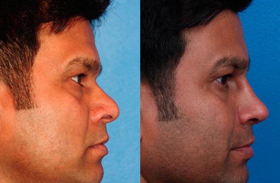 Images Gotham Plastic Surgery