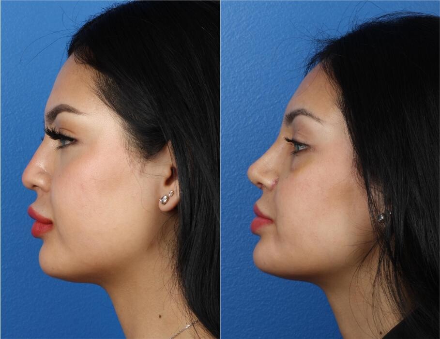 Images Gotham Plastic Surgery