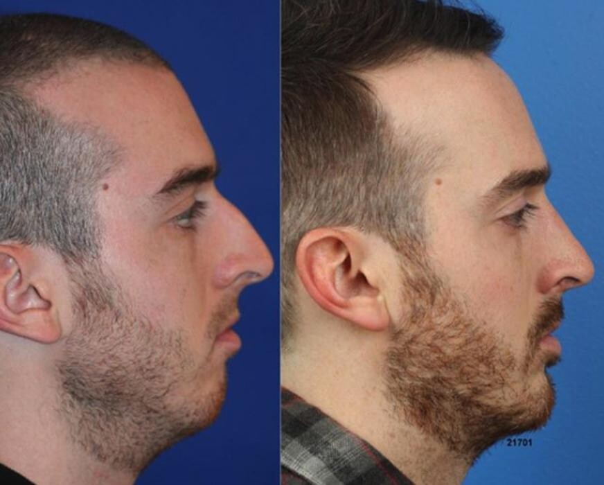 Images Gotham Plastic Surgery