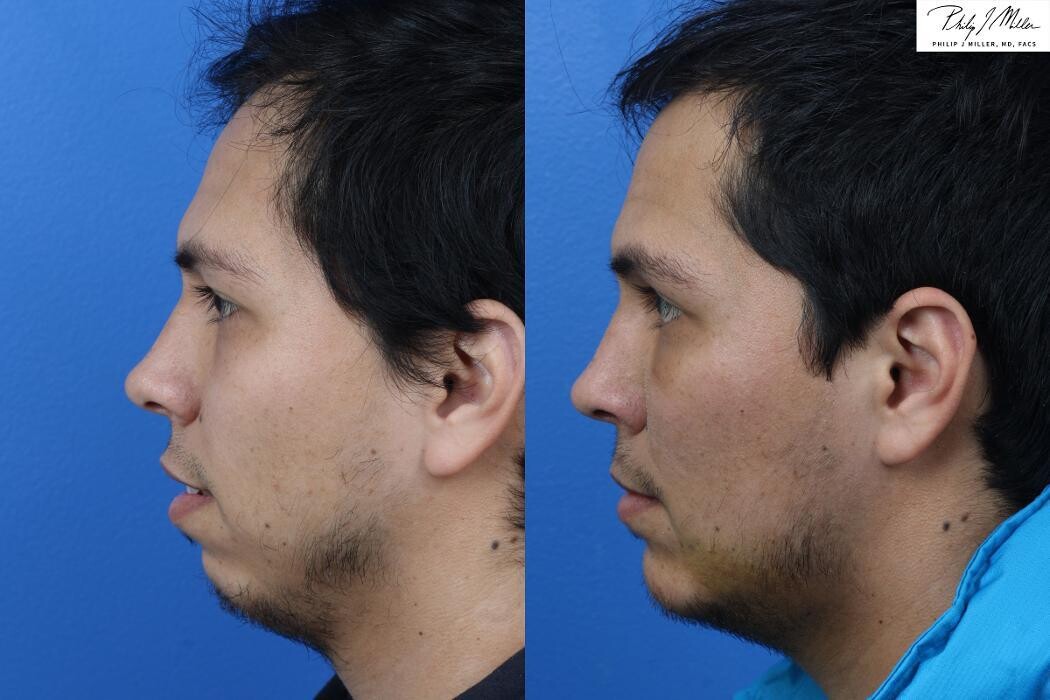 Images Gotham Plastic Surgery