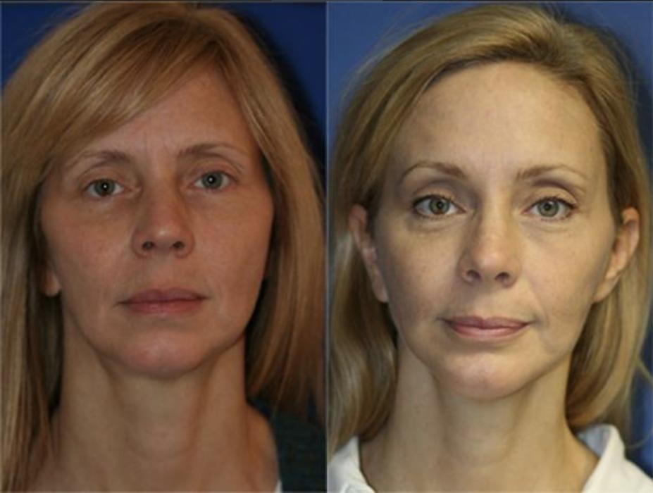Images Gotham Plastic Surgery