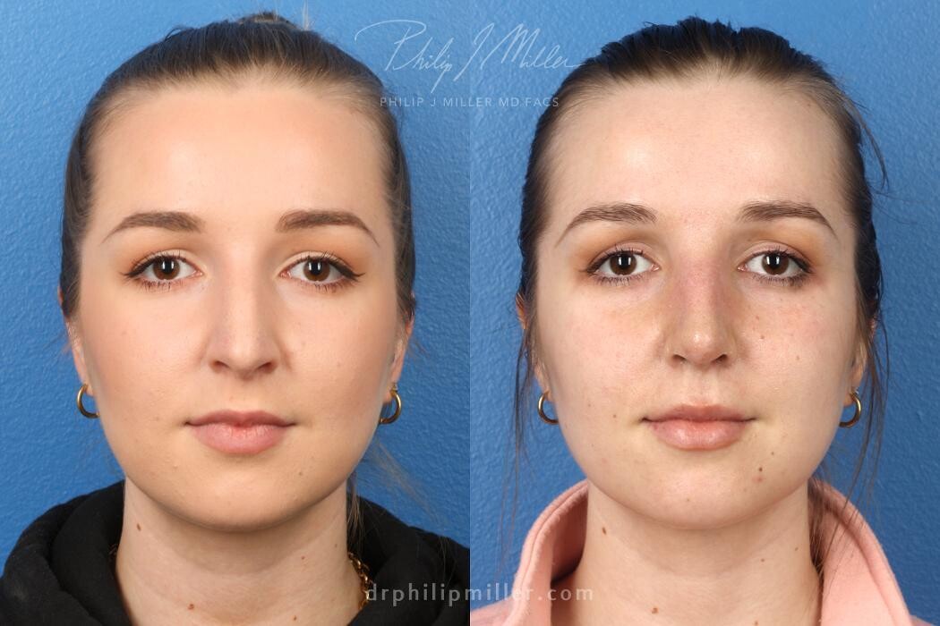 Images Gotham Plastic Surgery