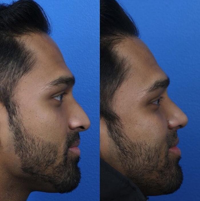 Images Gotham Plastic Surgery