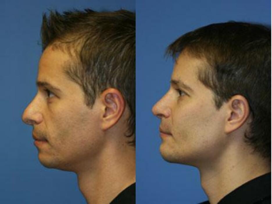 Images Gotham Plastic Surgery