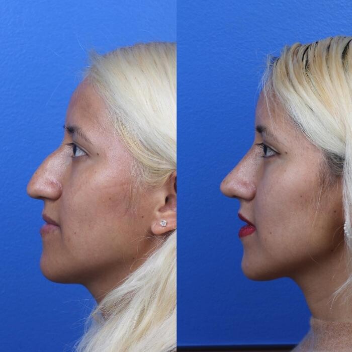 Images Gotham Plastic Surgery