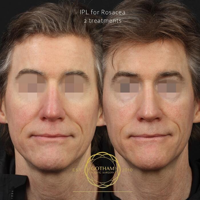 Images Gotham Plastic Surgery