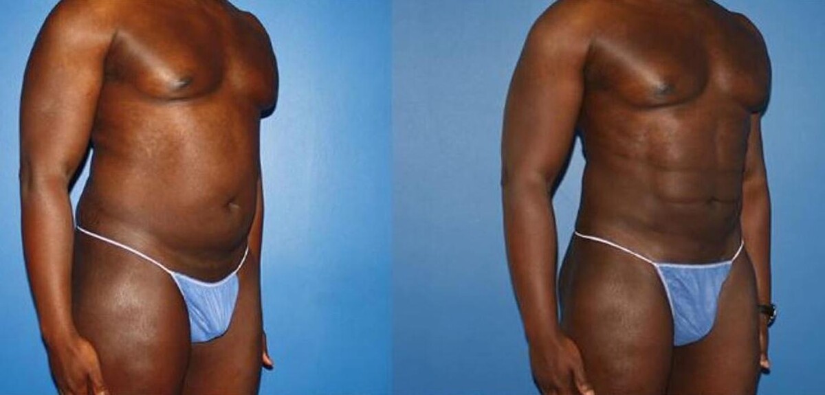 Images Gotham Plastic Surgery