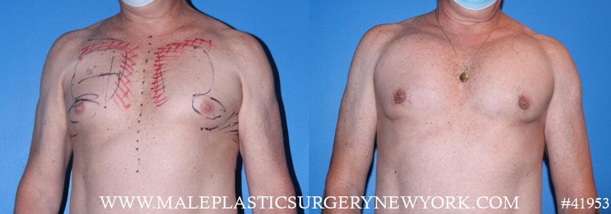 Images Gotham Plastic Surgery