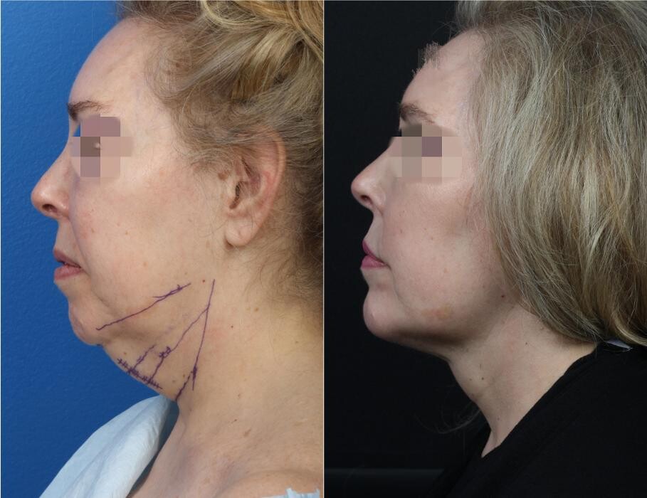 Images Gotham Plastic Surgery