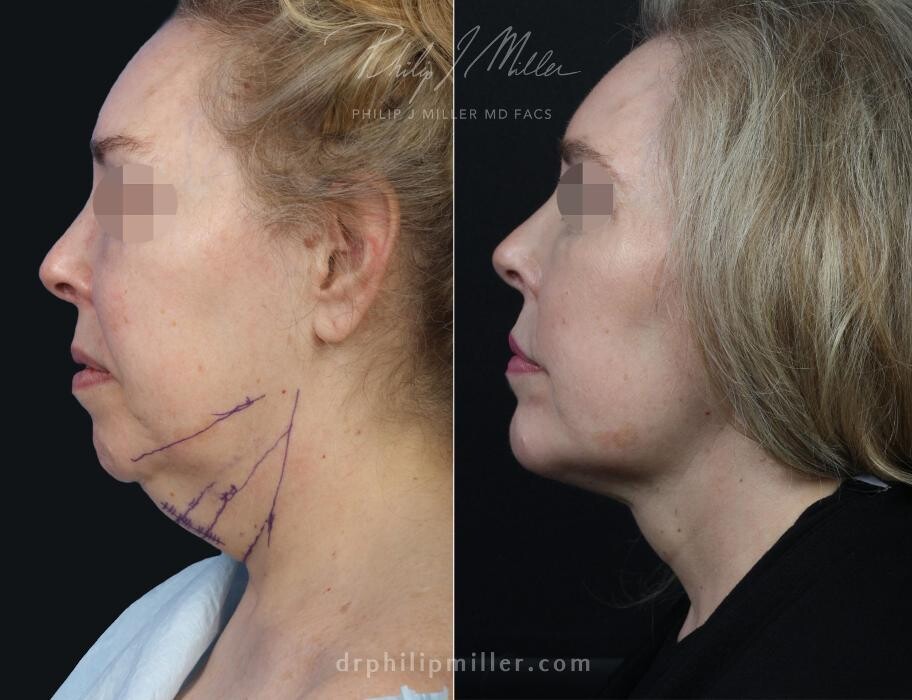 Images Gotham Plastic Surgery
