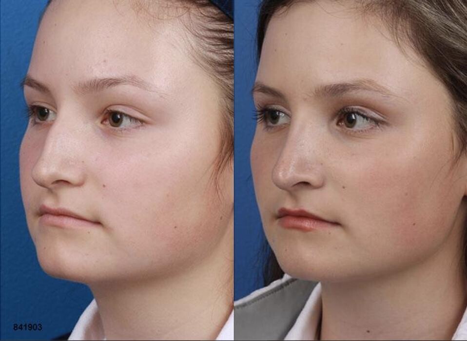 Images Gotham Plastic Surgery